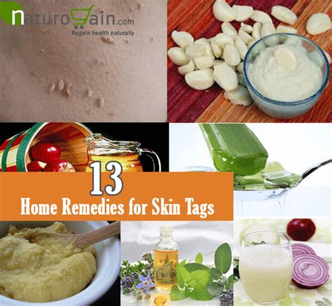 13 simple and best home remedies for skin tags that work home