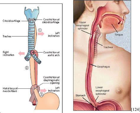 clinicaly derived dose response relations  esophageal