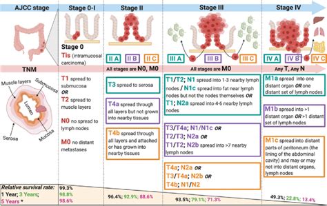 Colorectal Cancer Stages According To The American Joint Committee On