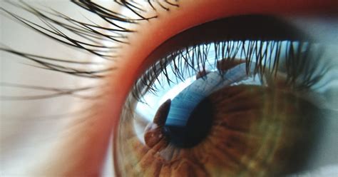 eyelash mites symptoms   treatments