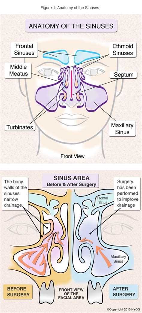 sinus anatomy sinus diagram