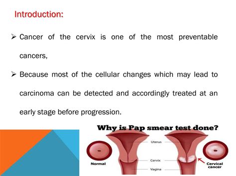 Ppt Cytopathology 4 Powerpoint Presentation Free Download Id 5355015