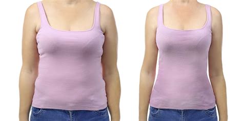 breast reduction surgery before weight loss cosmetic surgery tips
