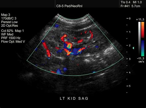 ultrasound scans    work