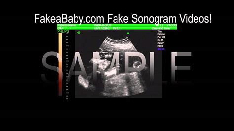 fake sonogram video sample youtube