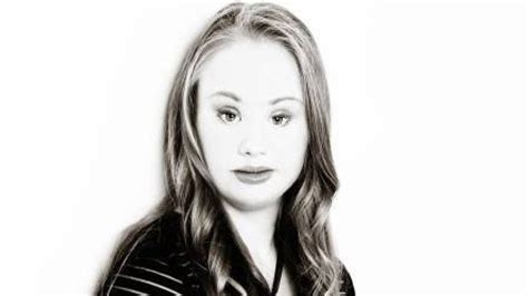 Model With Down S Syndrome Madeline Stuart Lands Fitness Wear
