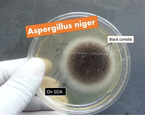 aspergillus niger introduction pathogenecity laboratory diagnosis