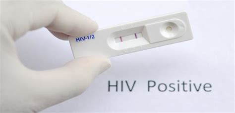 Hiv Diagnosis — 5 Tests To Detect A Recent Hiv Infection Read Health