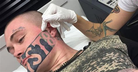 Teen With Devast8 Prison Tattoo Across Face Undergoes