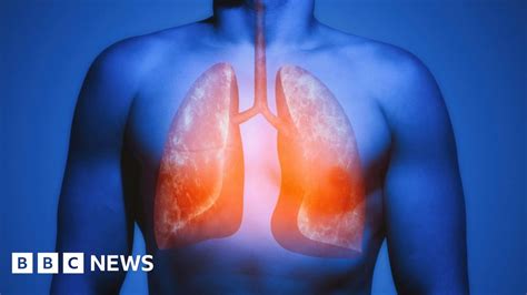 Lungs Magically Heal Damage From Smoking Bbc News