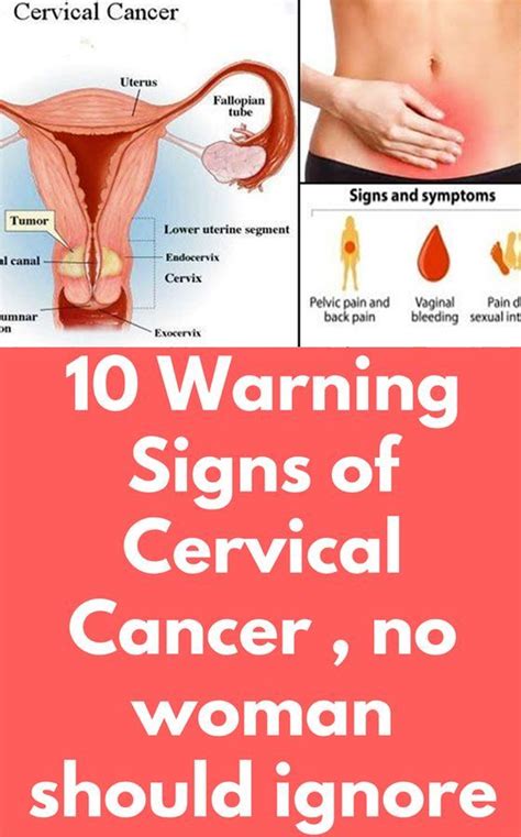 10 Warning Signs Of Cervical Cancer No Woman Should