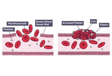 igcse biology notes  understand  platelets  involved