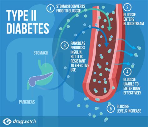 type  diabetes curable      yuri elkaim