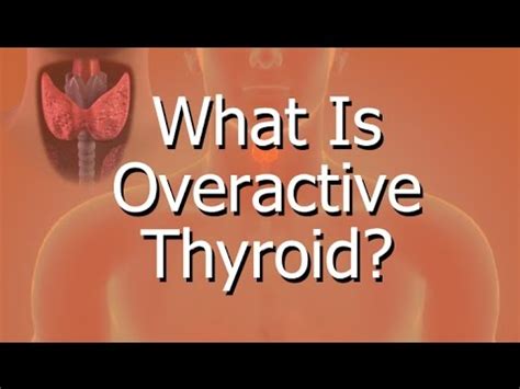 overactive thyroid youtube