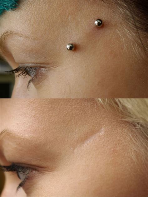 Dermal Piercing Pictures Procedure Aftercare And Risks Tatring