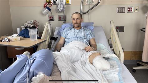 Local Man Loses Leg In Workplace Accident Ckpgtoday Ca