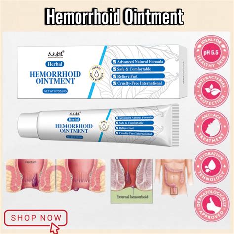 authentic hemorrhoid ointment internal hemorrhoids external hemorrhoids