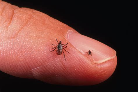 minnesota health official warns   lyme carrying ticks