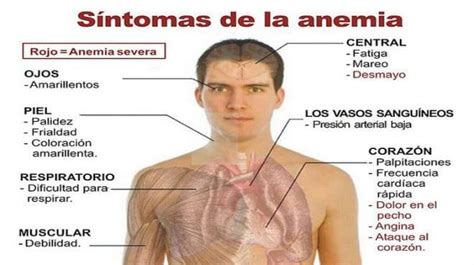 SÍntomas De La Anemia Causas Tipos Y Tratatiento [2020]
