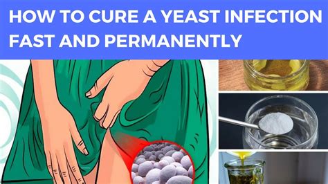 How To Cure A Yeast Infection Fast And Permanently Yeast Infection
