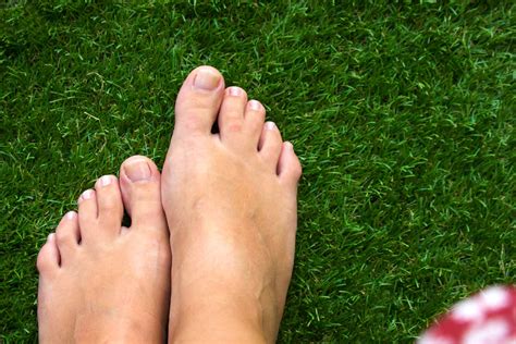 webbed toes   treatments canyon oaks podiatrist  visalia