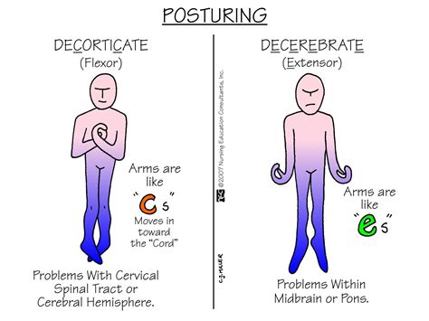 posturing nursing mnemonics surgical nursing medical surgical nursing