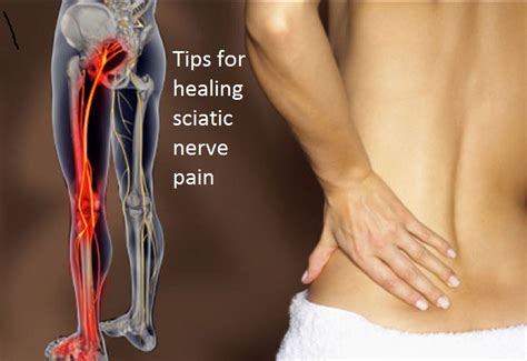 10 Tips For Healing Sciatic Nerve Pain According To Health Articles
