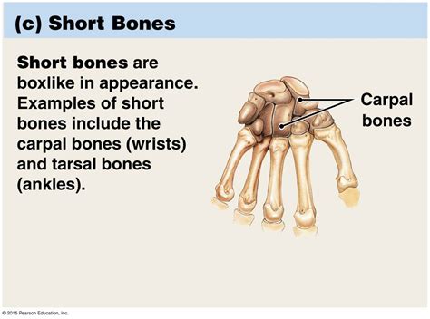 examples  short bones slideshare