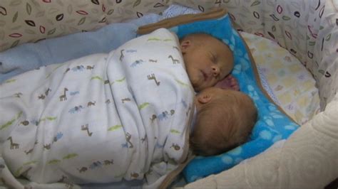 Conjoined Twins Arrive Home After Defying Odds Video Abc News