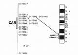 Chromosome Banding Giemsa Gene Carney Localization Ideogram Indicate 17q sketch template