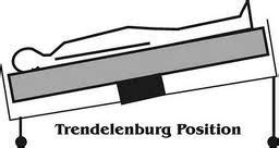trendelenburg position nursing students positivity abdominal surgery