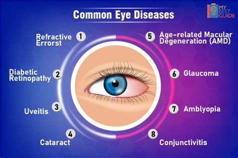Eye Diseases Symptoms Of Eye Problems And Defects