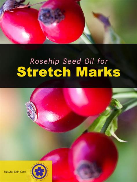 Rosehip Oil For Stretch Marks Natural Skin Remedies