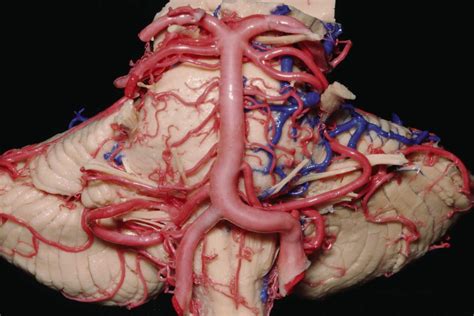 blood supply   brainstem neuroanatomy  neurosurgical atlas