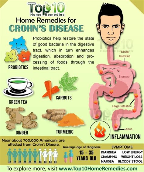 home remedies for crohn s disease top 10 home remedies