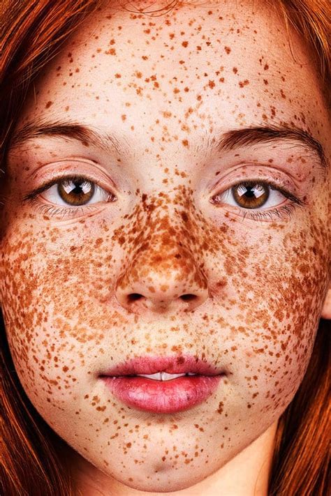 Photos Of People With Freckles Popsugar Beauty Photo 4