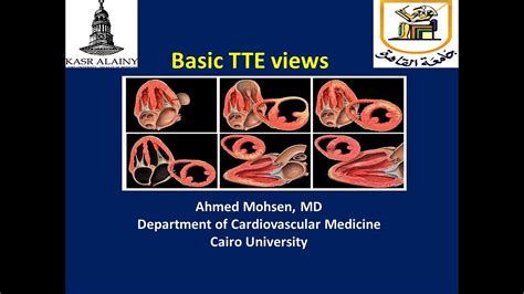 basic transthoracic echocardiography tte views youtube
