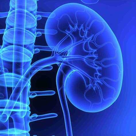 kidney failure treatment dr yasir unani herbal hospital research