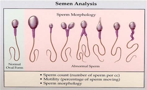 Everything You Need To Know About Abnormal Sperm Morphology And Its