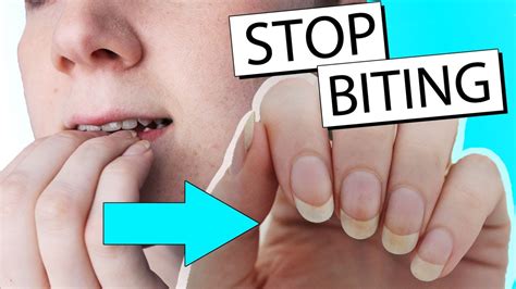kids  stop biting  nails  tips