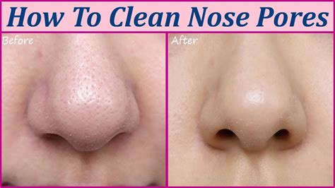 clean  nose pores  home grizzbye