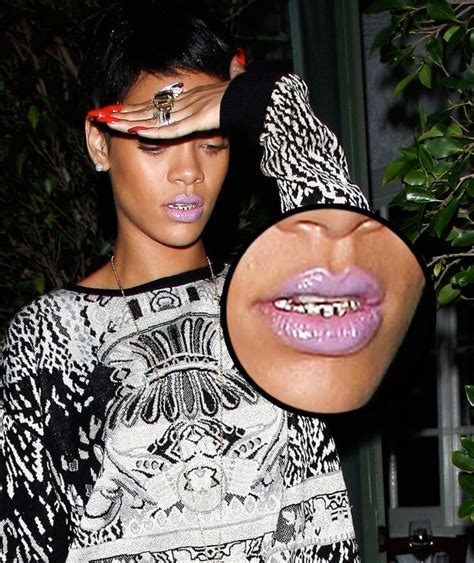 Rihanna Shows Off Her Controversial New Grill After Partying In
