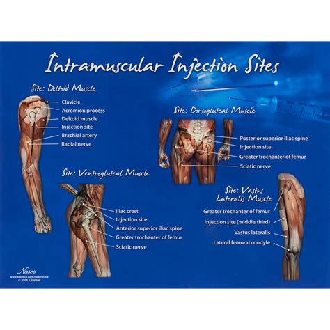 intramuscular injection sites chart nasco healthcare