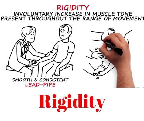 spasticity  rigidity spasticity rigidity comparison
