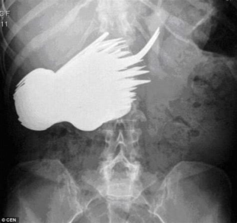 31 funny x ray images that seem too ridiculous to be real