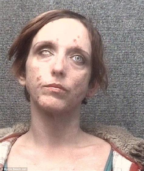 Prostitute With One Eye Is Arrested Over South Carolina Prostitution