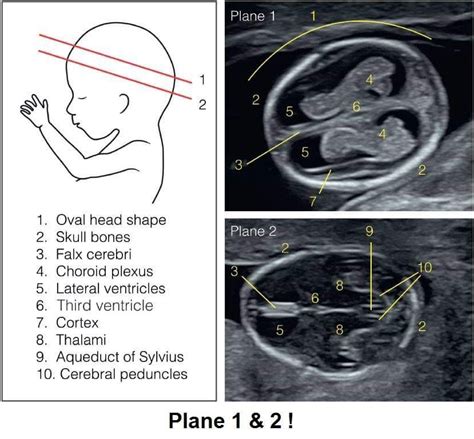 abnormal baby head ultrasound dbabyzi