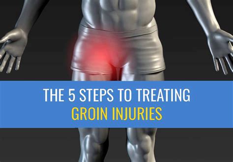 steps  treating groin injuries sports injury physio