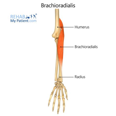 brachioradialis rehab  patient