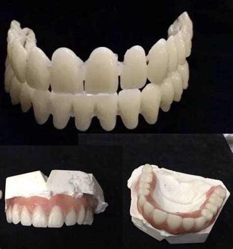 denture diy denture false teeth kit upper  missing